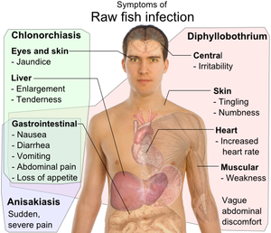 Symptoms_of_Raw_fish_infection