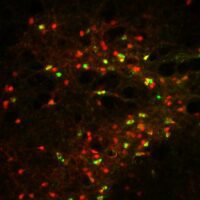 I neuroni CRH nella regione IPACL producono una proteina fluorescente rossa che consente la visualizzazione. Se i neuroni CRH sono collegati alla substantia nigra nel mesencefalo, l'etichettatura retrograda li colora inoltre di verde. Attestazione: Simon Chang