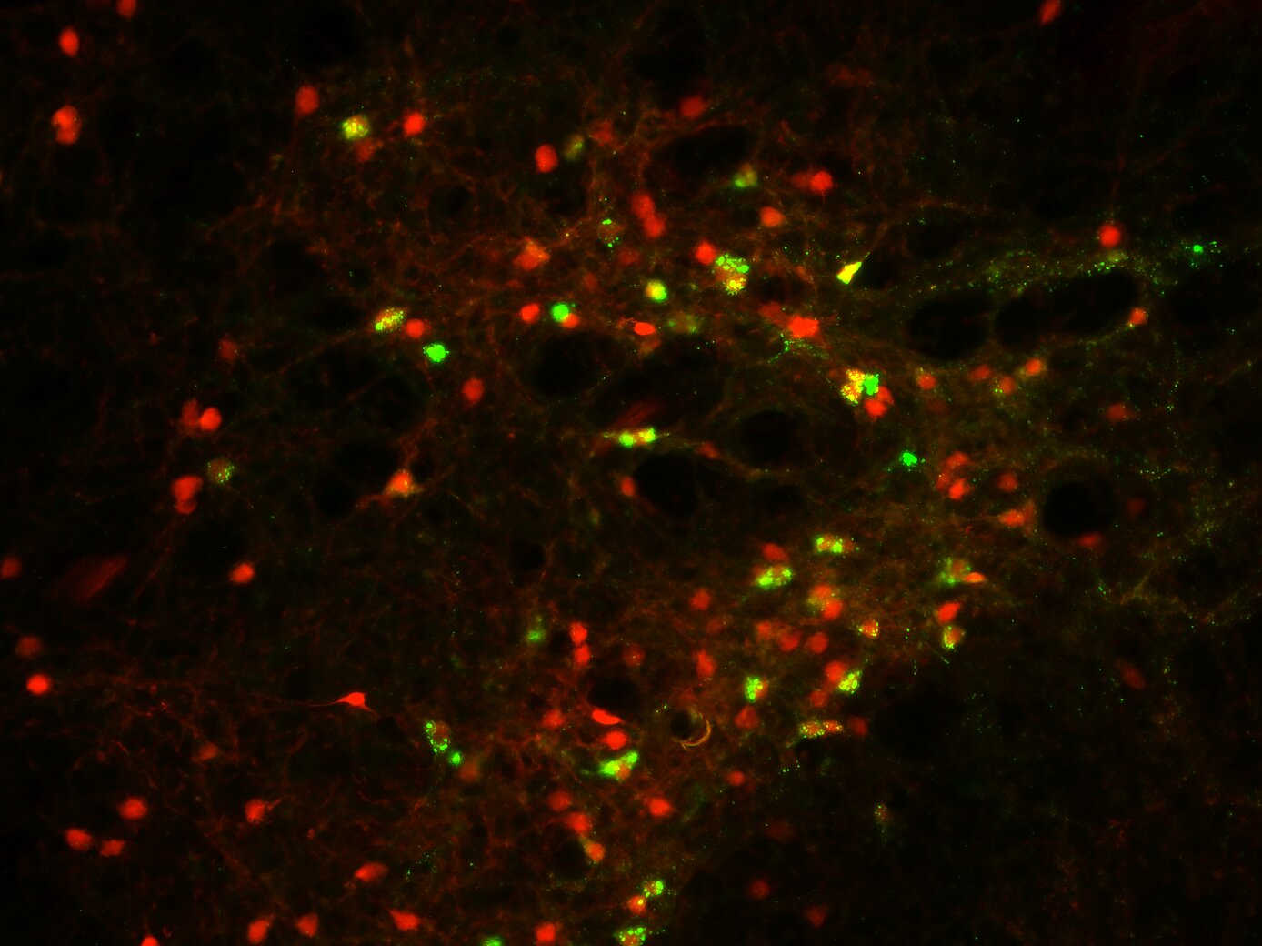 I neuroni CRH nella regione IPACL producono una proteina fluorescente rossa che consente la visualizzazione. Se i neuroni CRH sono collegati alla substantia nigra nel mesencefalo, l'etichettatura retrograda li colora inoltre di verde. Attestazione: Simon Chang