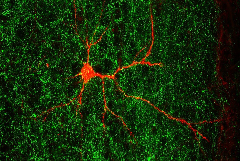 La connettività cerebrale viene modificata dopo la rimozione di un gene associato all'autismo. Il neurone si trova su un lato del cervello (etichettato in rosso) e le terminazioni nervose provengono dall'altro lato del cervello (etichettato in verde). Credito: Camilo Ferrer