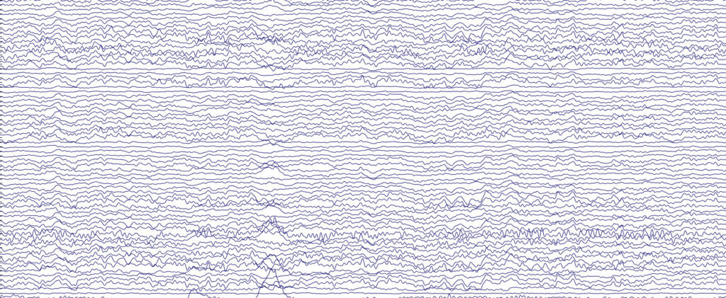 L'attività cerebrale nel tempo di un partecipante allo studio, registrata in diversi punti del cuoio capelluto dal cappuccio EEG come parte dell'esperimento. Credito: Università di Cambridge