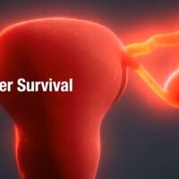 L’aspirina semplice a basso dosaggio può aumentare la sopravvivenza al cancro ovarico
