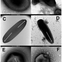 Caratteristiche morfologiche che guidano l'identificazione preliminare di virus appena isolati (colorazione negativa, TEM). (A) La grande particella ovoidale (1000 nm di lunghezza) di Pandoravirus yedoma (ceppo Y2) che mostra l'apice ostiolo (punta di freccia bianca) e lo spesso tegumento caratteristico della famiglia Pandoraviridae. (B) Una miscela di particelle oblate di mammut Pandoravirus (ceppo Yana14) e di particelle icosaedriche di mammut Megavirus (ceppo Yana14) che esibiscono uno "stargate" (struttura simile a una stella marina bianca che incorona un vertice, punta di freccia bianca). (C) La particella allungata di Cedratvirus lena (ceppo DY0) (1500 nm di lunghezza) presenta due strutture apicali simili a sughero (punte di freccia bianche). (D) La particella allungata del mammut Pithovirus (1800 nm di lunghezza) che presenta una singola struttura simile a un tappo di apice (punta di freccia bianca). (E) Il grande (770 nm di diametro) "Virus (2023). DOI: 10.3390/v15020564