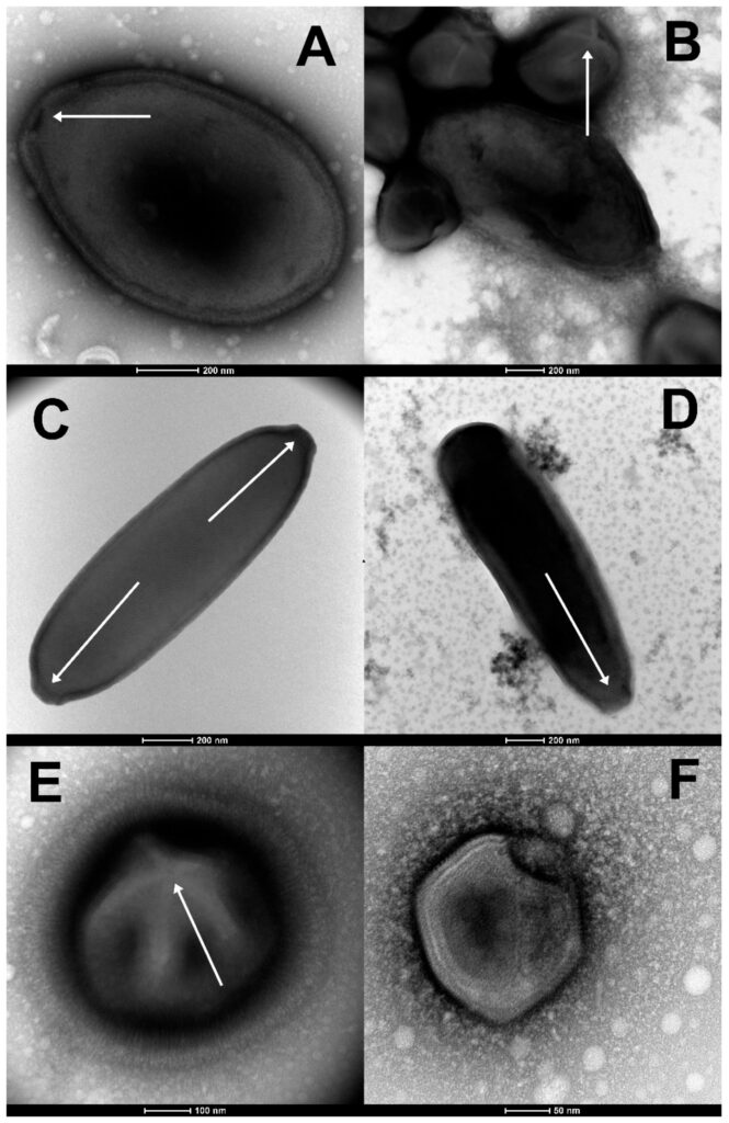 Caratteristiche morfologiche che guidano l'identificazione preliminare di virus appena isolati (colorazione negativa, TEM). (A) La grande particella ovoidale (1000 nm di lunghezza) di Pandoravirus yedoma (ceppo Y2) che mostra l'apice ostiolo (punta di freccia bianca) e lo spesso tegumento caratteristico della famiglia Pandoraviridae. (B) Una miscela di particelle oblate di mammut Pandoravirus (ceppo Yana14) e di particelle icosaedriche di mammut Megavirus (ceppo Yana14) che esibiscono uno "stargate" (struttura simile a una stella marina bianca che incorona un vertice, punta di freccia bianca). (C) La particella allungata di Cedratvirus lena (ceppo DY0) (1500 nm di lunghezza) presenta due strutture apicali simili a sughero (punte di freccia bianche). (D) La particella allungata del mammut Pithovirus (1800 nm di lunghezza) che presenta una singola struttura simile a un tappo di apice (punta di freccia bianca). (E) Il grande (770 nm di diametro) "Virus (2023). DOI: 10.3390/v15020564