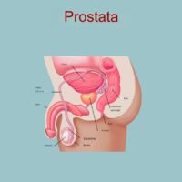 Parliamo di Prostata e Prostatite Benigna con le Opzioni di trattamento
