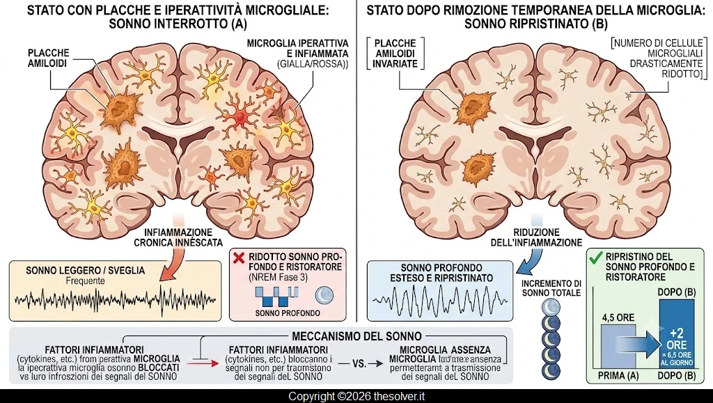I ricercatori hanno scoperto un sorprendente responsabile della privazione del sonno nella malattia di Alzheimer: le cellule immunitarie del cervello stesso. Nei topi con placche amiloidi, l'iperattività della microglia ha innescato un'infiammazione che ha impedito al cervello di ottenere un sonno profondo e ristoratore a sufficienza. La rimozione temporanea della maggior parte di queste cellule ha ripristinato oltre due ore di sonno al giorno, anche se le placche sono rimaste invariate.