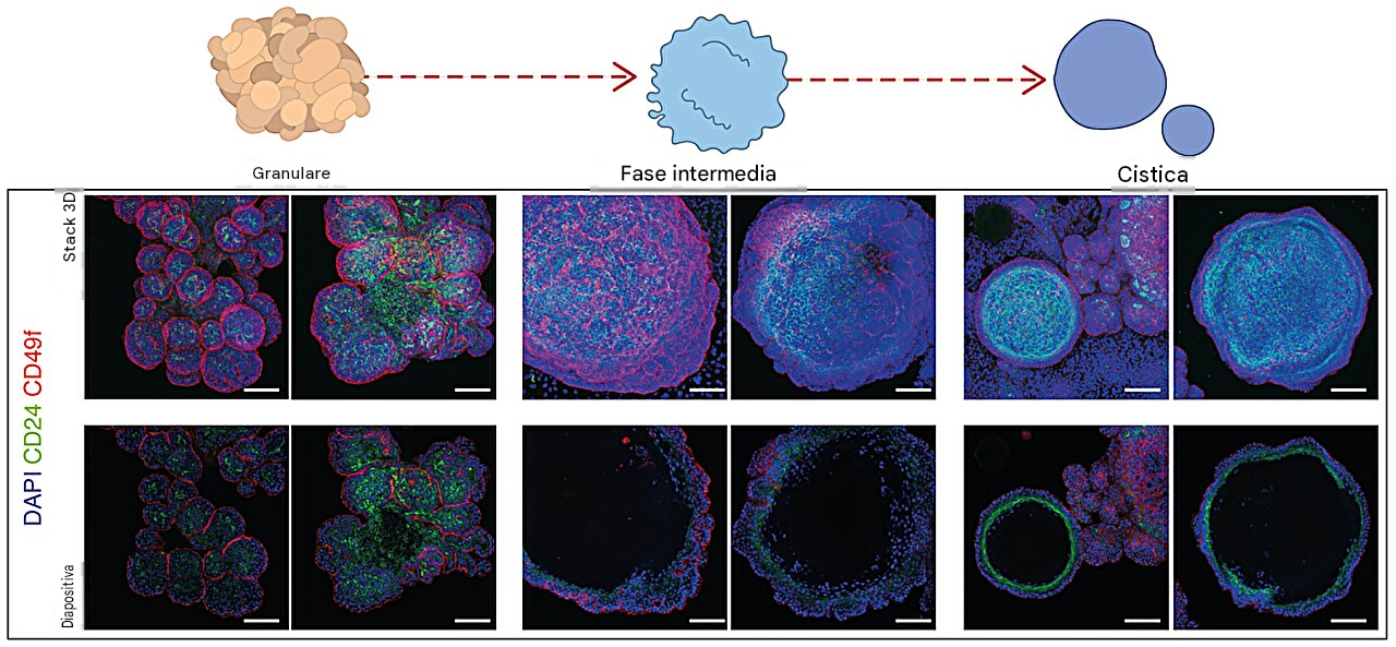 Immagini confocali di organoidi che mostrano cambiamenti temporali nella morfologia e nell'espressione dei marcatori dopo l'esposizione al THC. Fonte: Communications Biology (2026). DOI: 10.1038/s42003-026-10837-1 