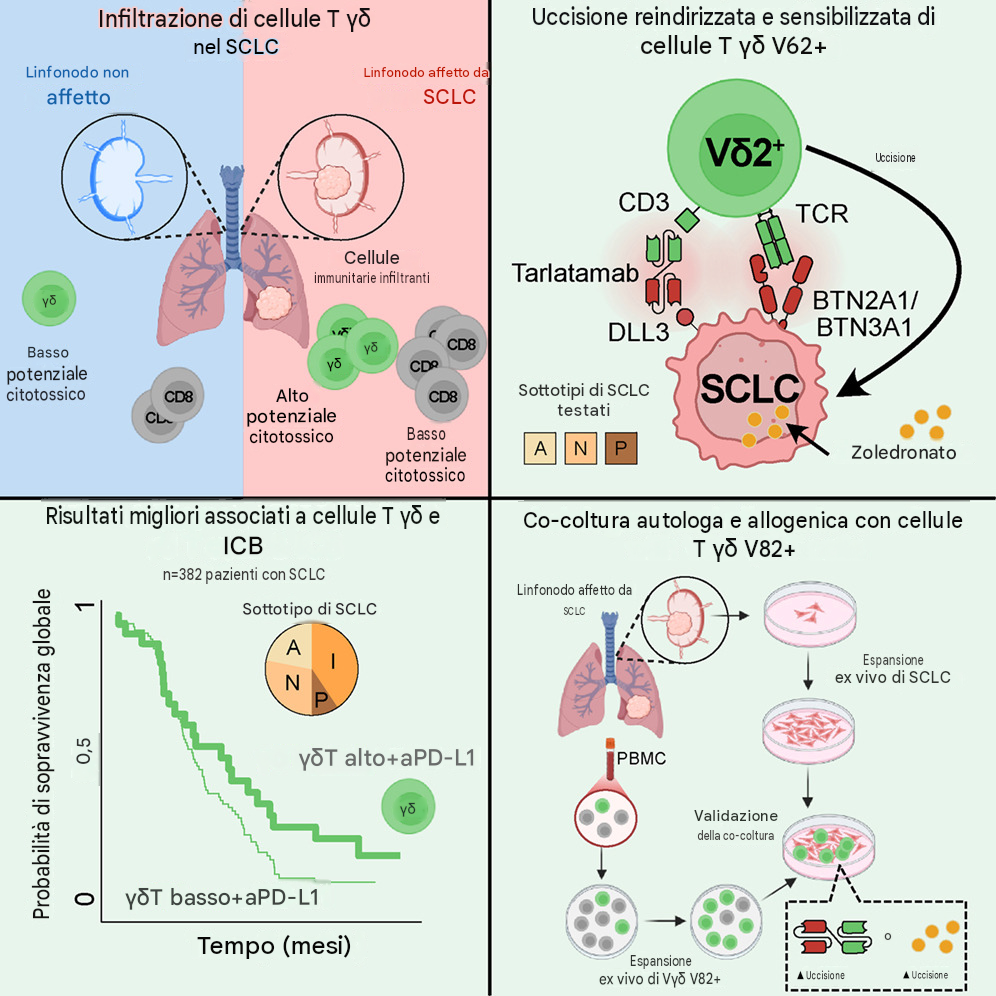 La somministrazione congiunta di zoledronato e tarlatamab ha generato un effetto sinergico straordinario, moltiplicando la capacità letale dei linfociti T gamma delta e dimostrando che la riqualificazione di farmaci esistenti può offrire risposte terapeutiche immediate.