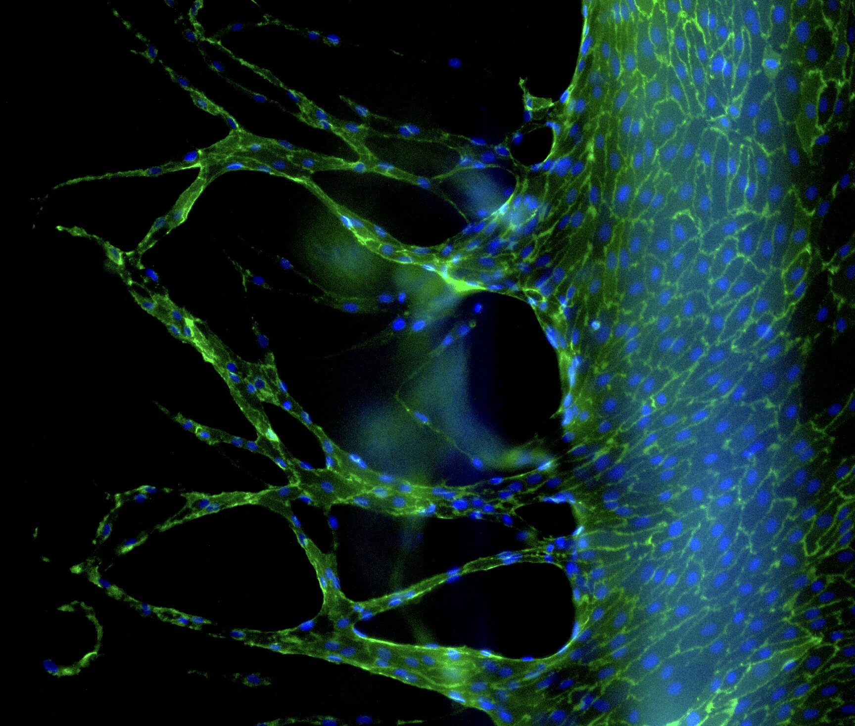 Nuovi vasi sanguigni che si formano da una vena artificiale rivestita di cellule endoteliali umane. Credito: Sarah Dobner