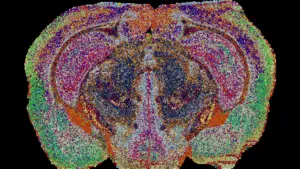 Mappare I Grassi Nel Cervello Svela Nuovi Territori E Dinamiche Biologiche